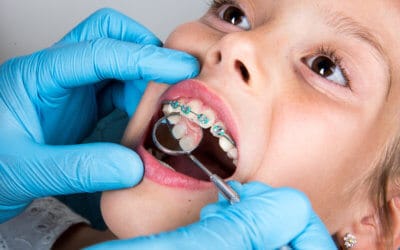 The Role of the Palatal Expander in Pediatric Orthodontistry