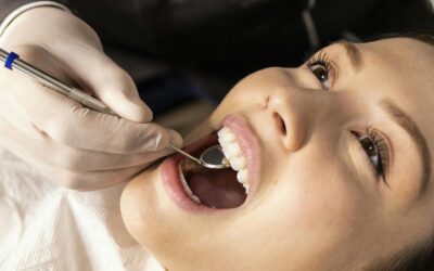 Palate Expander for Crossbite: A Complete Guide to Treatment